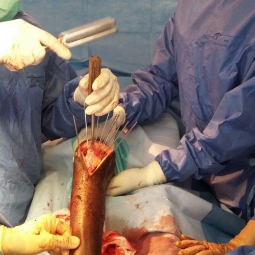 Chirurgie avec moyens du bord