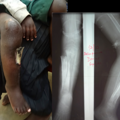 Radiographie de la jambe de Darius