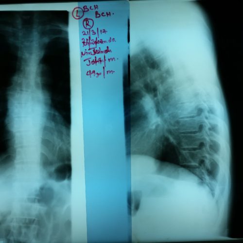 Une radiologie difficile