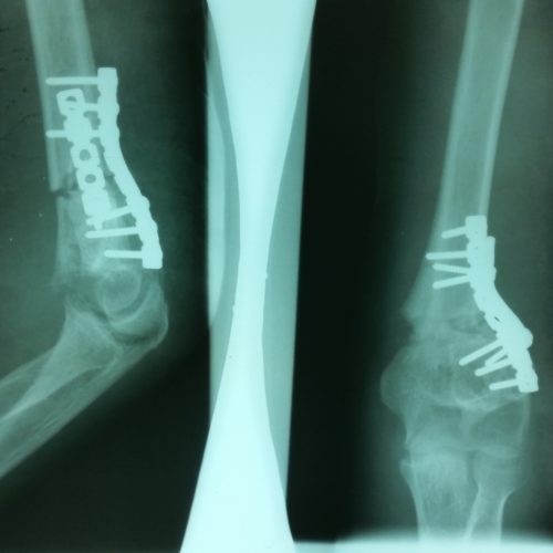 Une bonne radiographie est possible